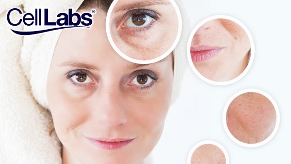 Image of a middle-aged woman in towel with signs of aging.